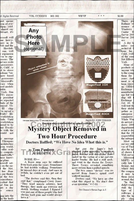 Fake Newspaper Article MYSTERY OBJECT REMOVED IN TWO HOUR PROCEDURE